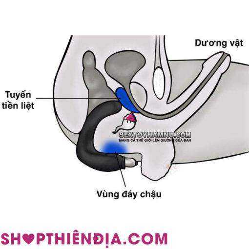 Cách đưa máy kích thích hậu môn đầu móc