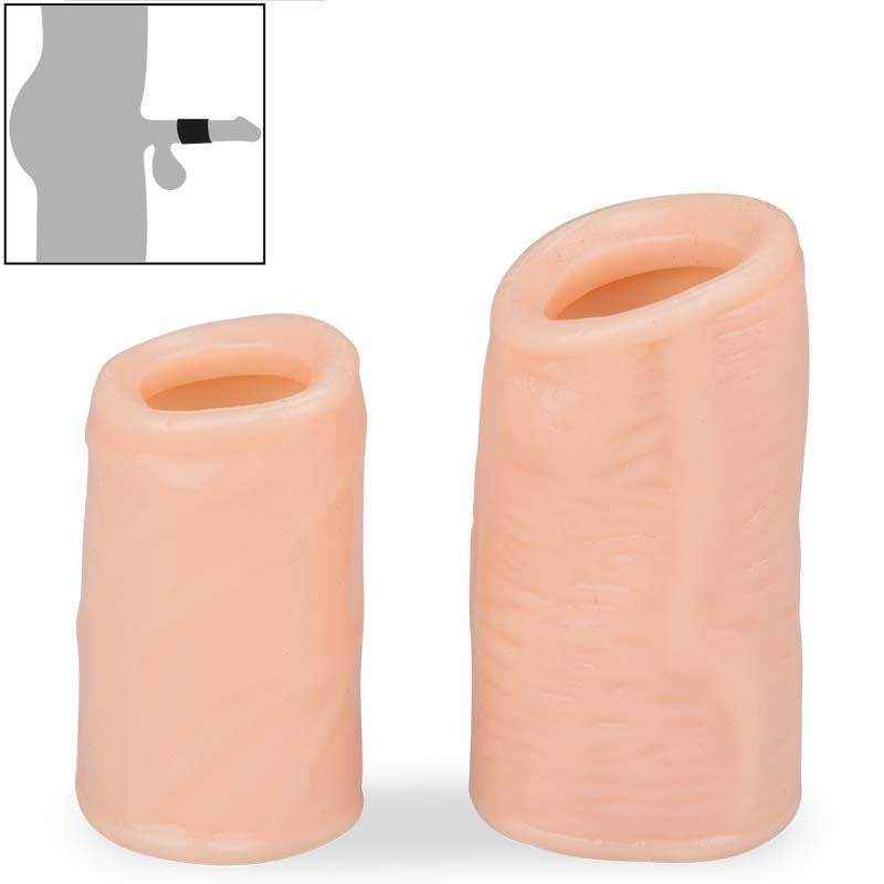 Bộ 2 cái bao cao su khúc Fraser